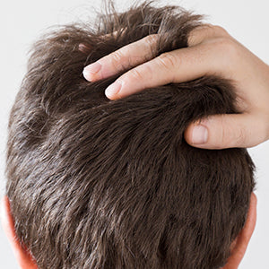 Dry Hair Treatment For Men