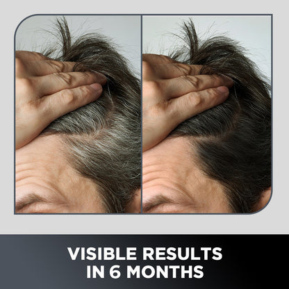 grey-hair-remedy-kit