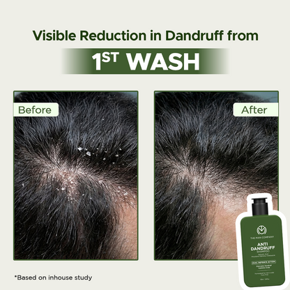 Anti-Dandruff Shampoo with AHA & BHA | Flake Control from First Wash (100ml)