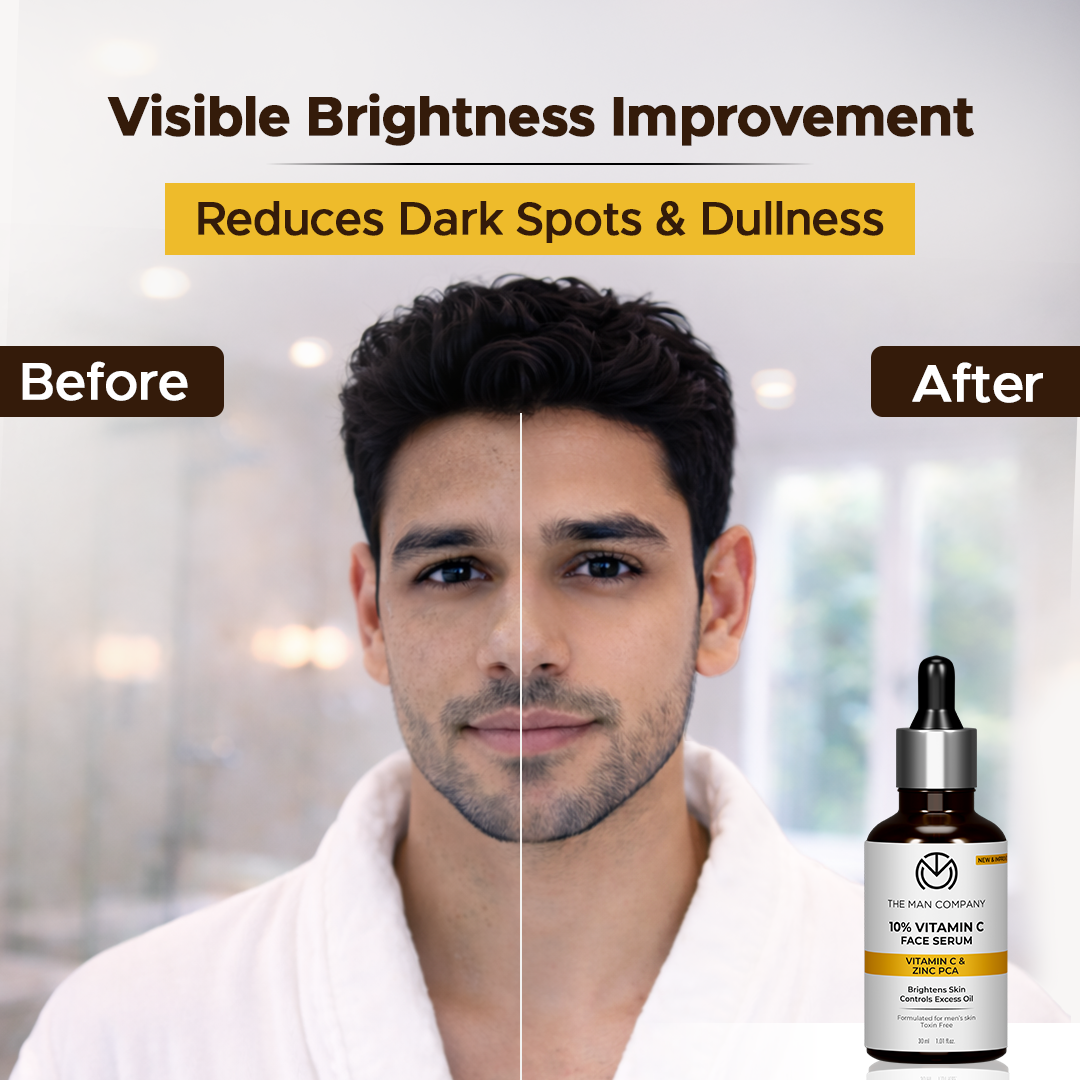 10% Vitamin C Face Serum for Man | Brightens Skin | Controls Excess Oil | Stable Vitamin C & Zinc PCA
