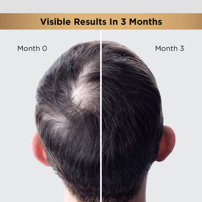 hair-growth-regime-kit