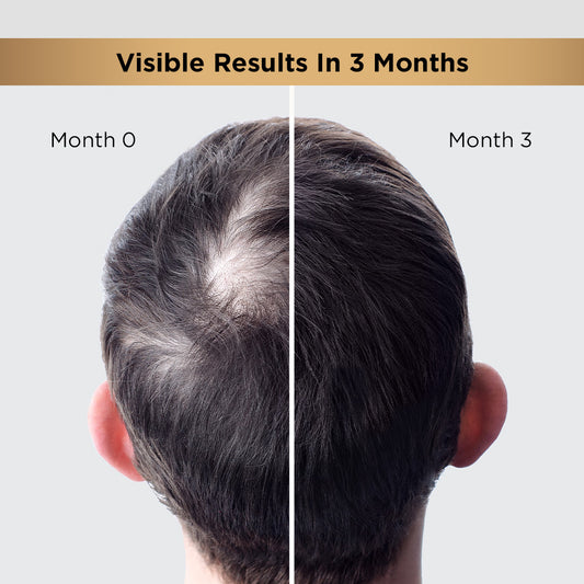 hair-growth-regime-kit